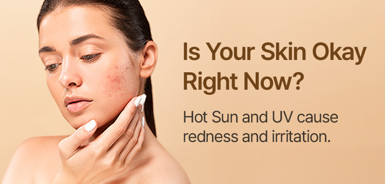 Is Your Skin Okay Right Now? Hot Sun and UV cause redness and irritation.