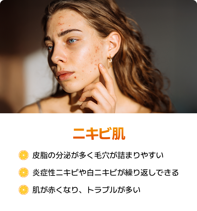 皮脂の分泌が多く毛穴が詰まりやすい · 炎症をニキビや白ニキビが繰り返しできる · 肌が赤くなりトラブルが多い