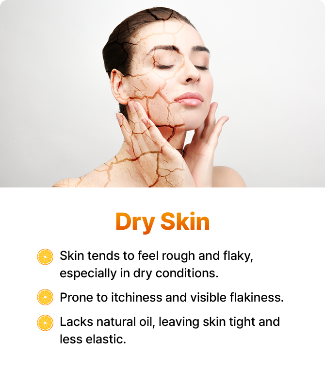 Skin tends to feel rough and flaky, especially in dry conditions. Prone to itchiness and visible flakiness. Lacks natural oil, leaving skin tight and less elastic.