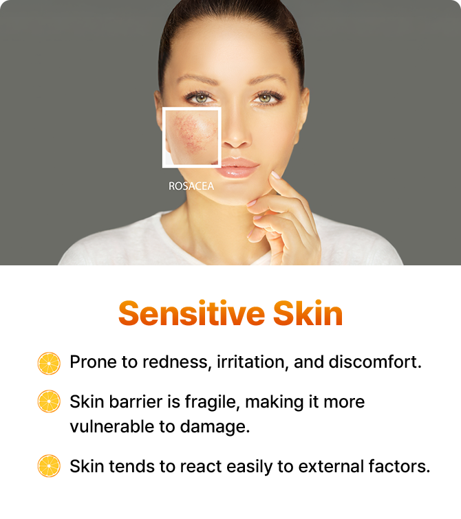 Prone to redness, irritation, and discomfort. Skin barrier is fragile, making it more vulnerable to damage. Skin tends to react easily to external factors.