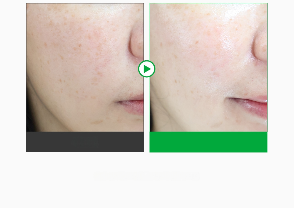 SUNGBOON EDITOR Green Tomato Pore Boosting Deep Shot Ampoule 30ml