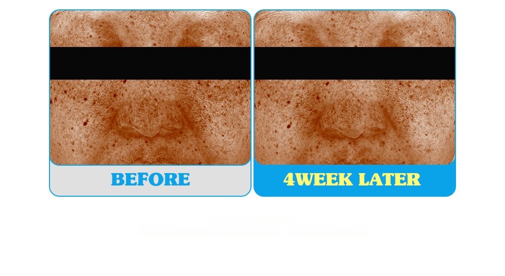 glutathione eye color before and after BRINGGREEN Super Lemon Cream 30ml Double Pack Eye cream for eye contour